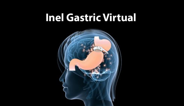 inelul-gastric-virtual